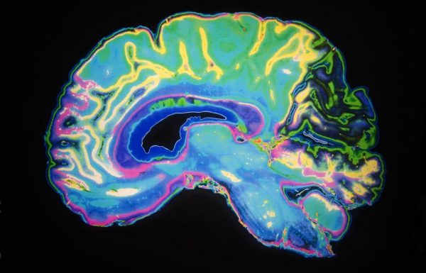 חוקרים גילו כי פיברומיאלגיה קשורה בדלקת מוחית מופשטת